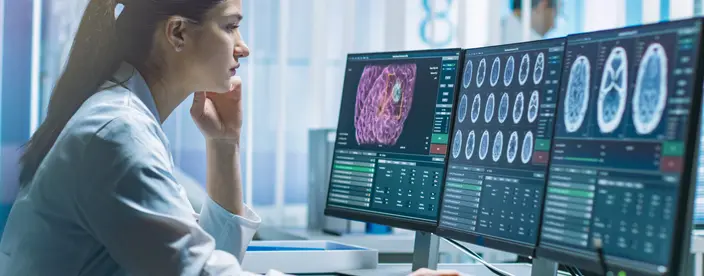 woman in lab coat looking at computer monitors displaying various brain scans