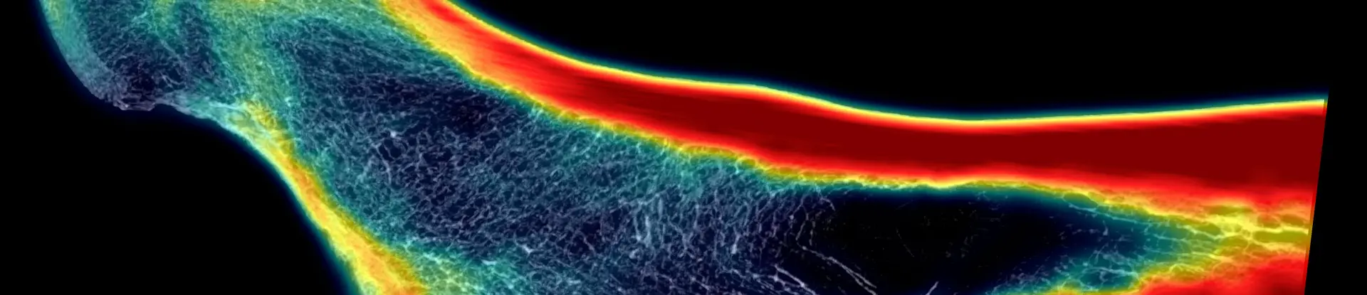 Colorful higher-resolution CT scan of a femur against a black background